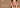 Freckles on Face: Why They Happen & How to Reduce Them