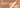 What Causes Lip Pigmentation and How to Reduce It: A Complete Guide