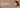 Hyperpigmentation Treatment India Natural: What Works and Why