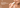 What Causes Lip Pigmentation and How to Reduce It: A Complete Guide
