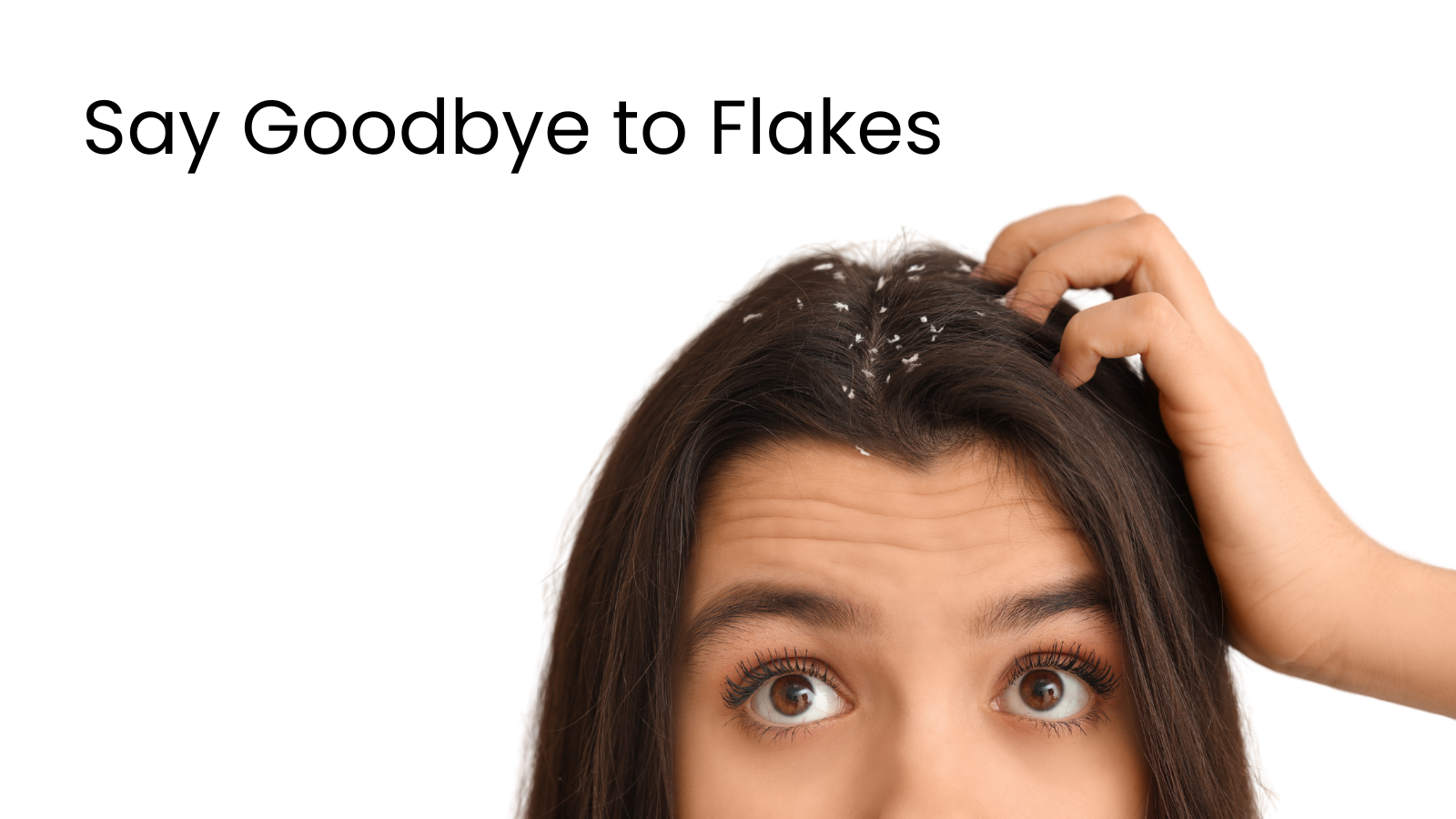 Scalp with visible hair flakes and dandruff buildup, indicating itchy, dry scalp problems—say goodbye to flakes with effective solutions.