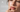 Why Your Lips Stay Dry Even After Using Lip Balm