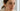 How To Get Rid Of Under Eye Wrinkles Naturally