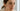 How To Get Rid Of Under Eye Wrinkles Naturally
