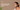 Hyperpigmentation Treatment India Natural: What Works and Why