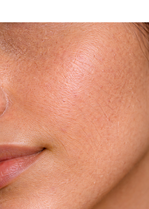 Skin Feels Tight & Dry