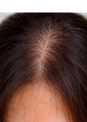 Hair Feels Weak & Falling