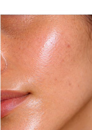 Skin Feels Oily & Heavy