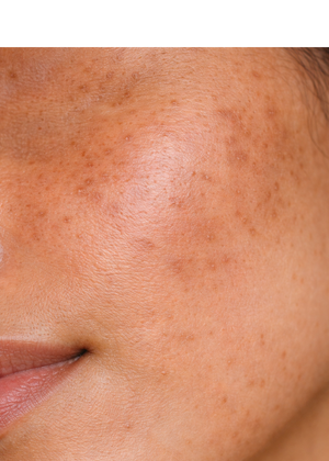 Skin Feels Dull & Tired