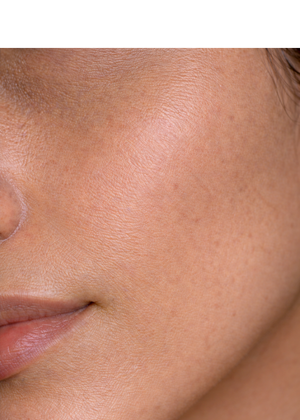 Skin Feels Patchy & Uneven