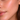 Combination Skin