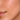 Dry Skin
