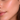 Normal Skin
