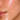 Oily Skin